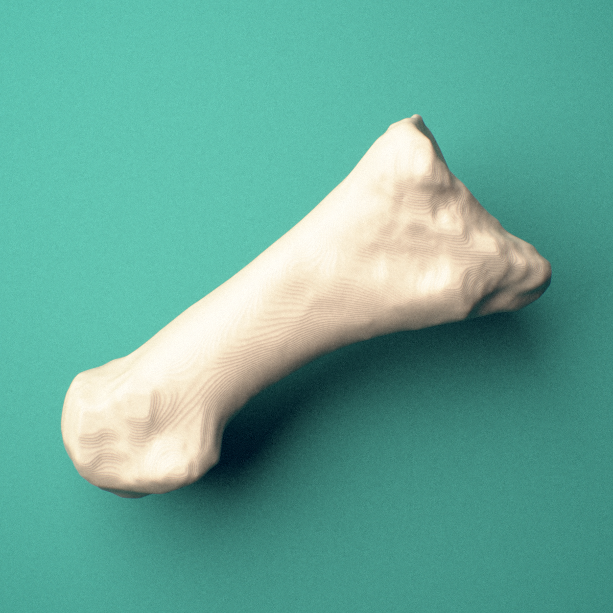 3D-printed Left first metatarsal (foot), oblique view showing the base and head.