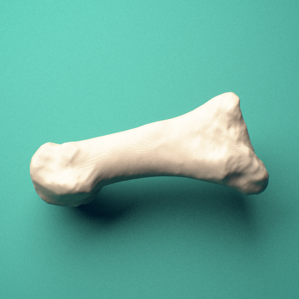 3D-printed Left first metatarsal (foot), close-up view showing the head.