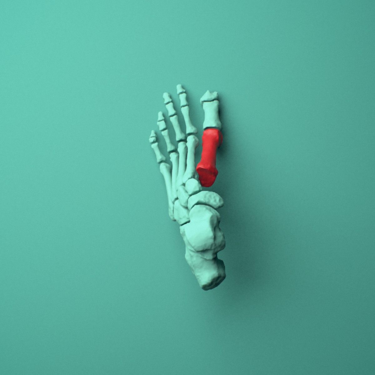 3D model of the Left first metatarsal (foot) shown in position within a full foot and ankle model, superior view.