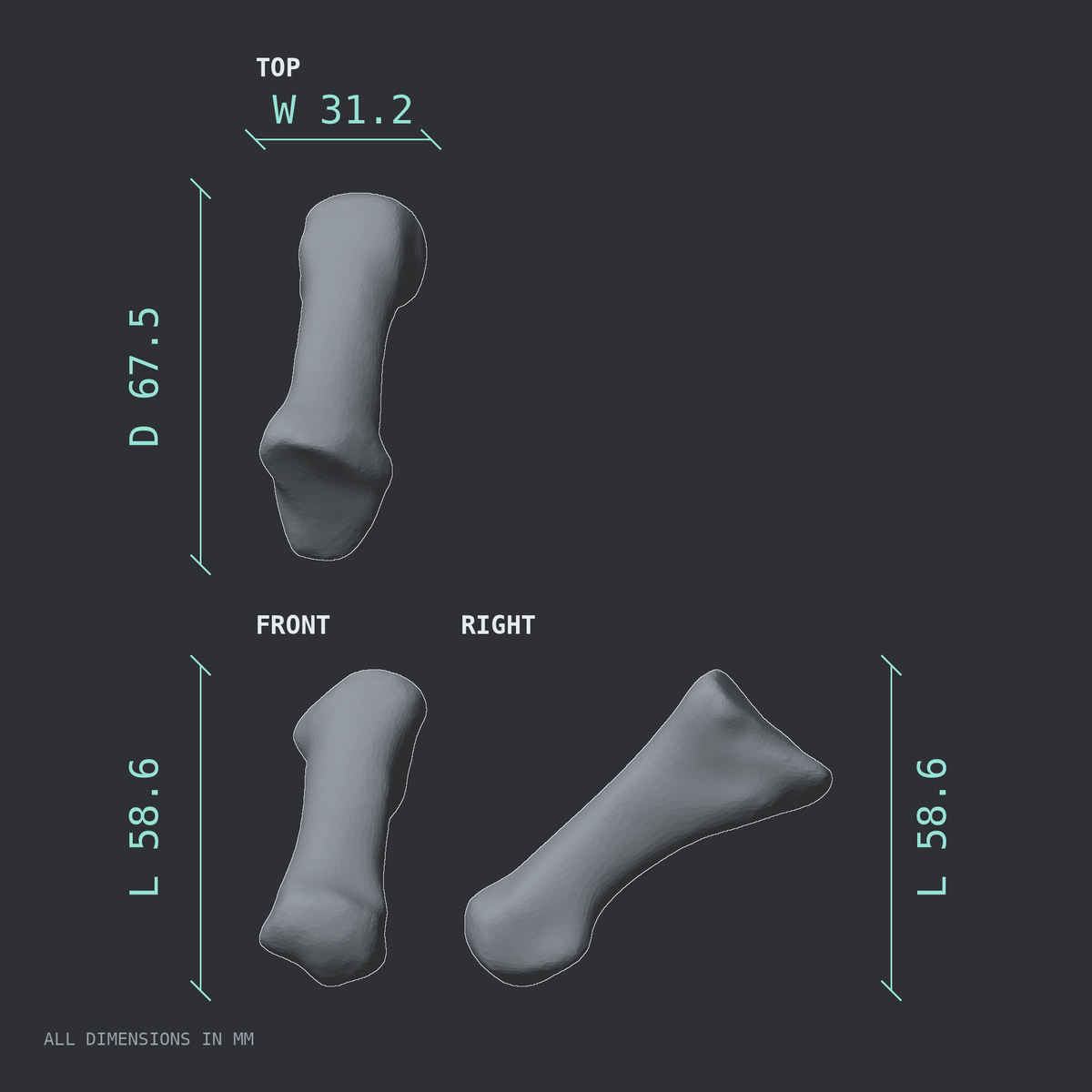 3D rendered dimensional drawing of the Left first metatarsal (foot), top, front, and side views.