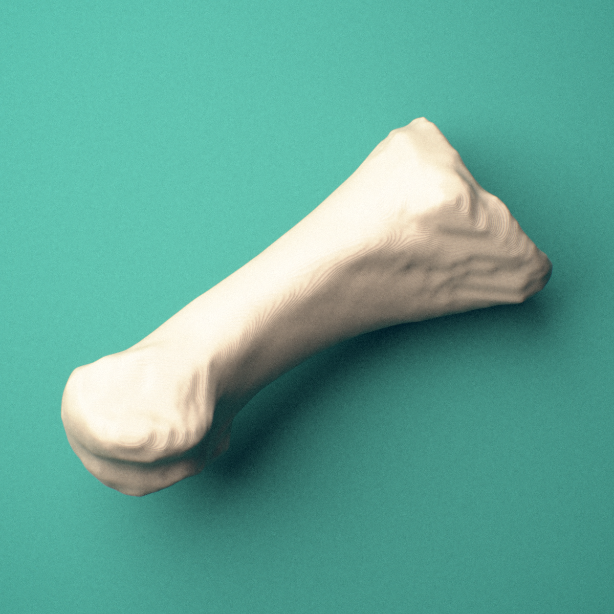 3D-printed Right first metatarsal (foot), oblique view showing the base and head.