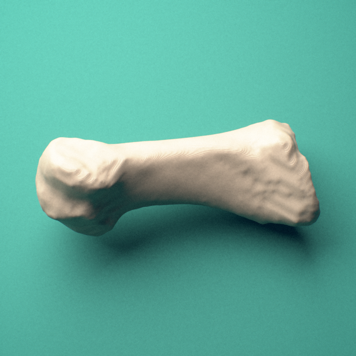 3D-printed Right first metatarsal (foot), close-up view showing the head.