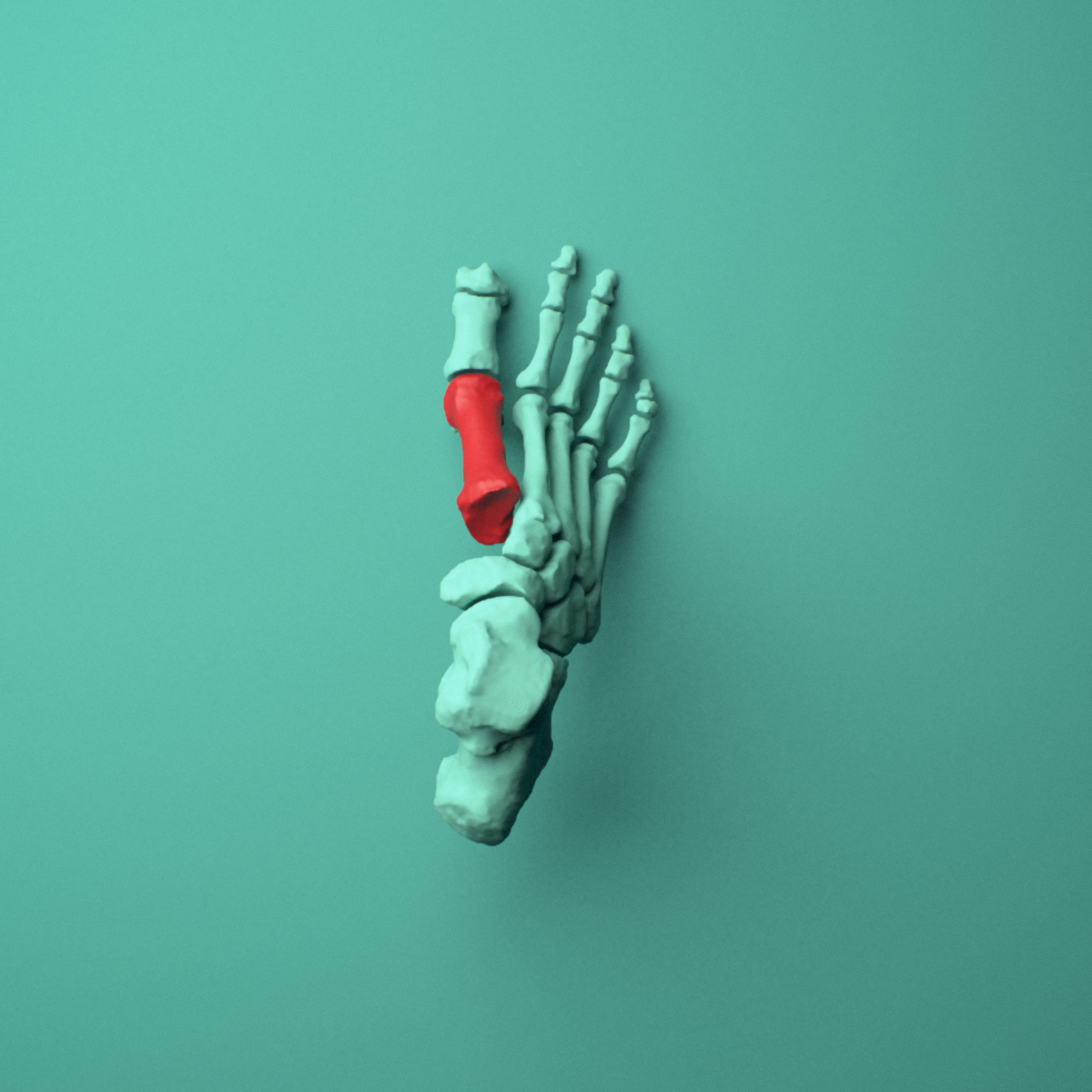 3D model of the Right first metatarsal (foot) shown in position within a full foot and ankle model, superior view.