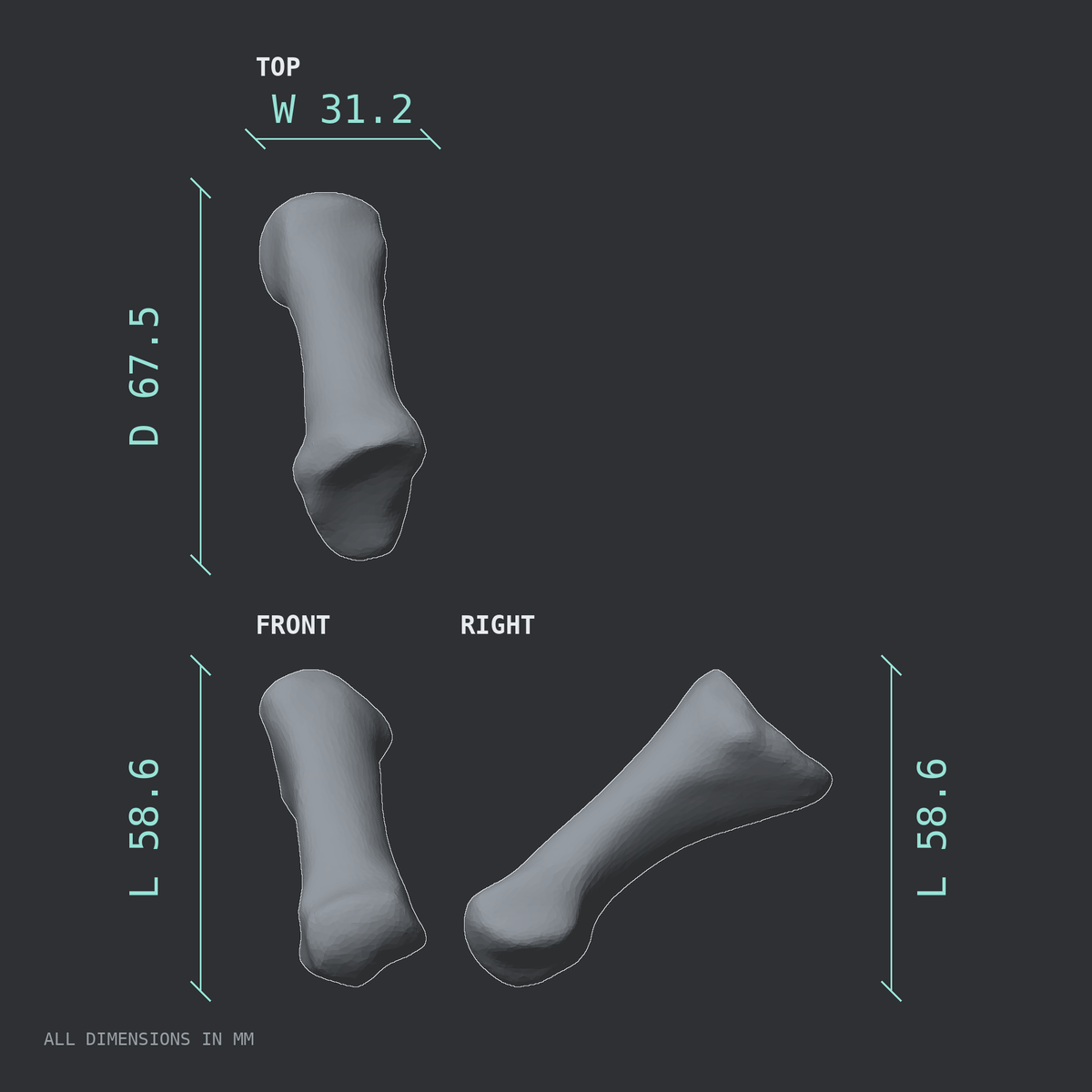 3D rendered dimensional drawing of the Right first metatarsal (foot), top, front, and side views.