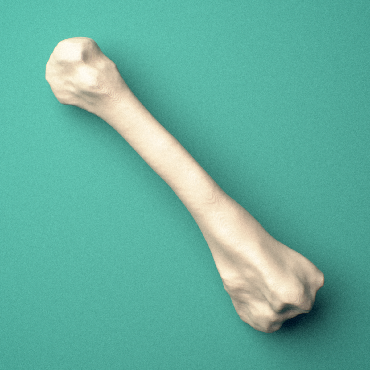 3D-printed Left second metatarsal (foot), oblique view showing the base and head.