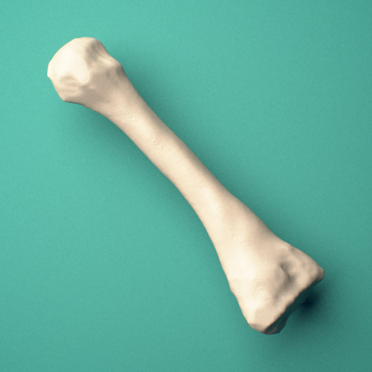 3D-printed Right second metatarsal (foot), oblique view showing the base and head.