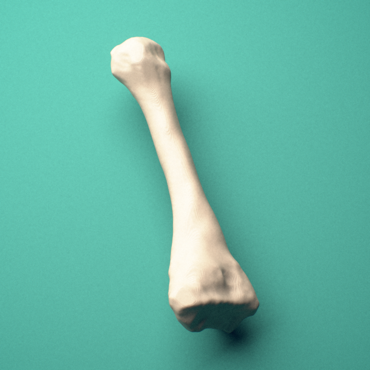 3D-printed Right second metatarsal (foot), close-up view showing the head.