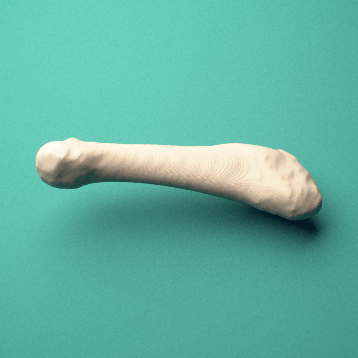 3D-printed Left fifth metatarsal (foot), close-up view showing the head.