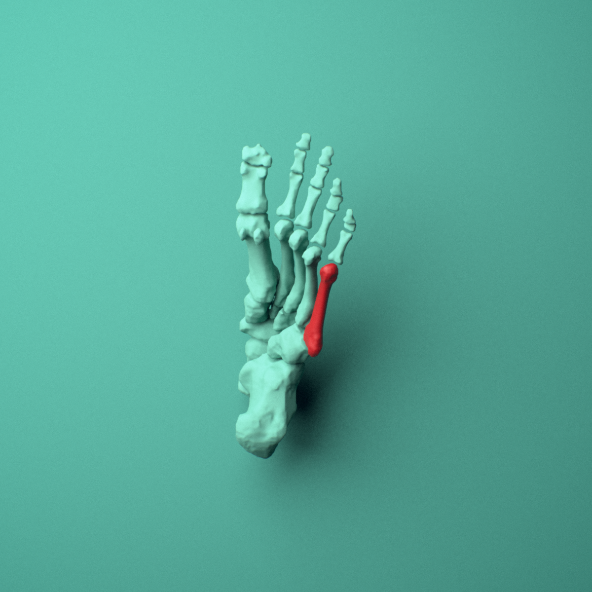 3D model of the Left fifth metatarsal (foot) shown in position within a full foot and ankle model, inferior view.