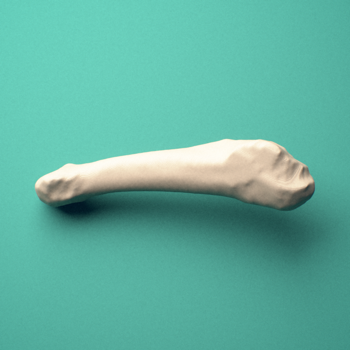 3D-printed Right fifth metatarsal (foot), close-up view showing the head.