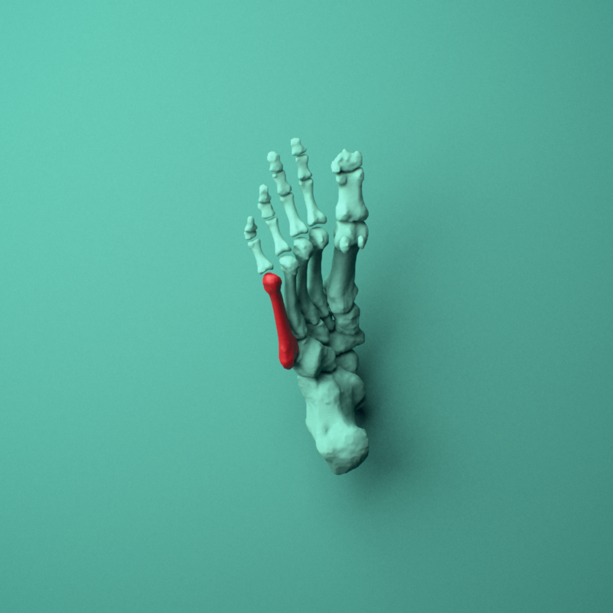 3D model of the Right fifth metatarsal (foot) shown in position within a full foot and ankle model, inferior view.
