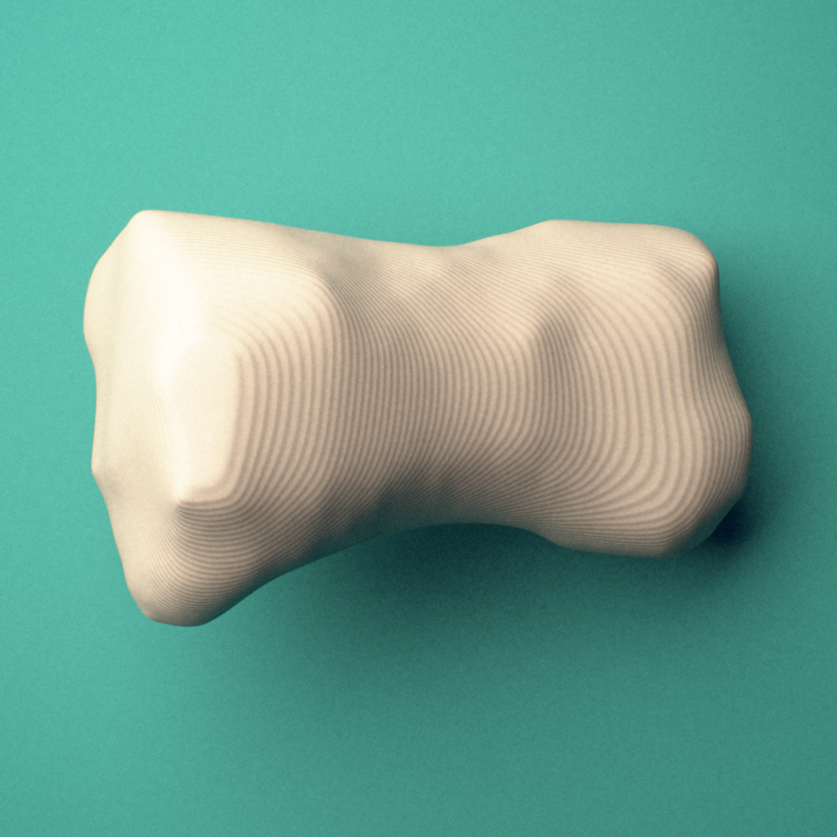 3D-printed Left second toe middle phalanx, oblique view showing the base and head (trochlea).