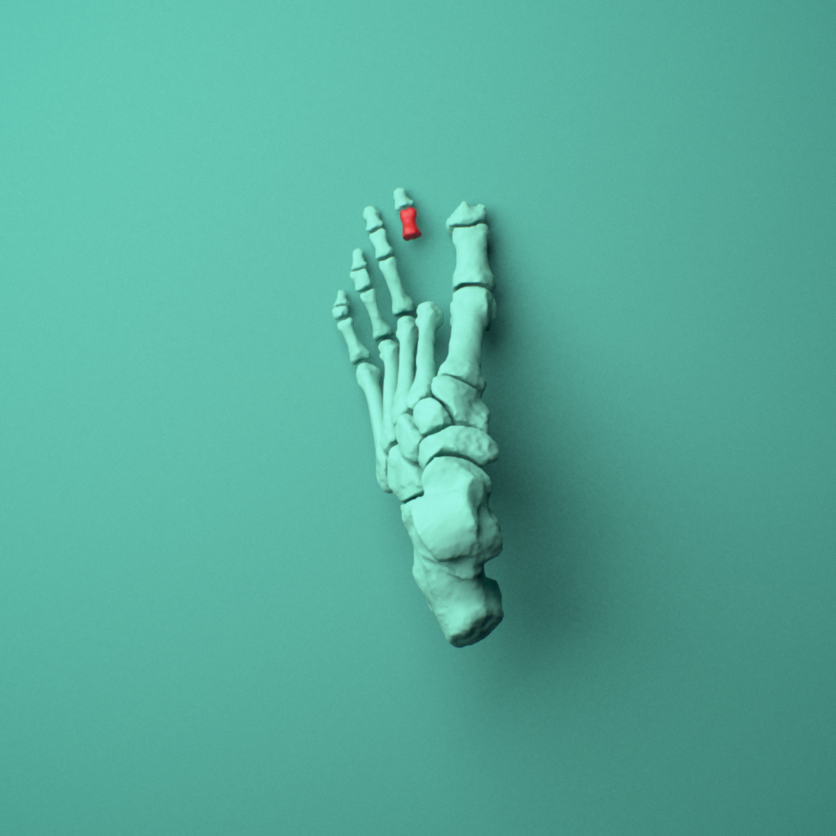 3D model of the Left second toe middle phalanx shown in position within a full foot and ankle model, superior view.