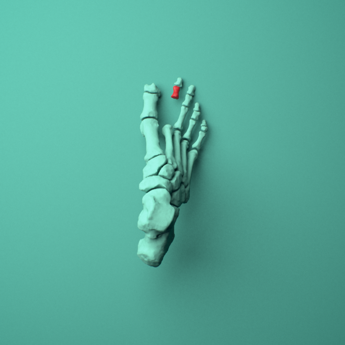 3D model of the Right second toe middle phalanx shown in position within a full foot and ankle model, superior view.