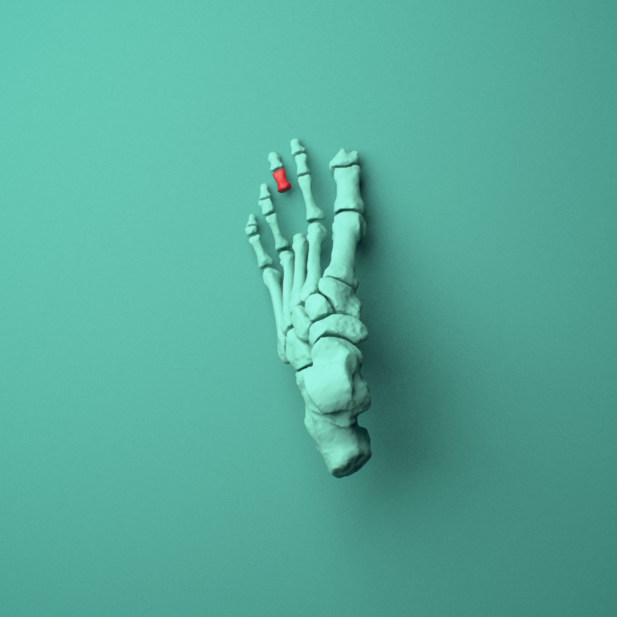 3D model of the Left third toe middle phalanx shown in position within a full foot and ankle model, superior view.