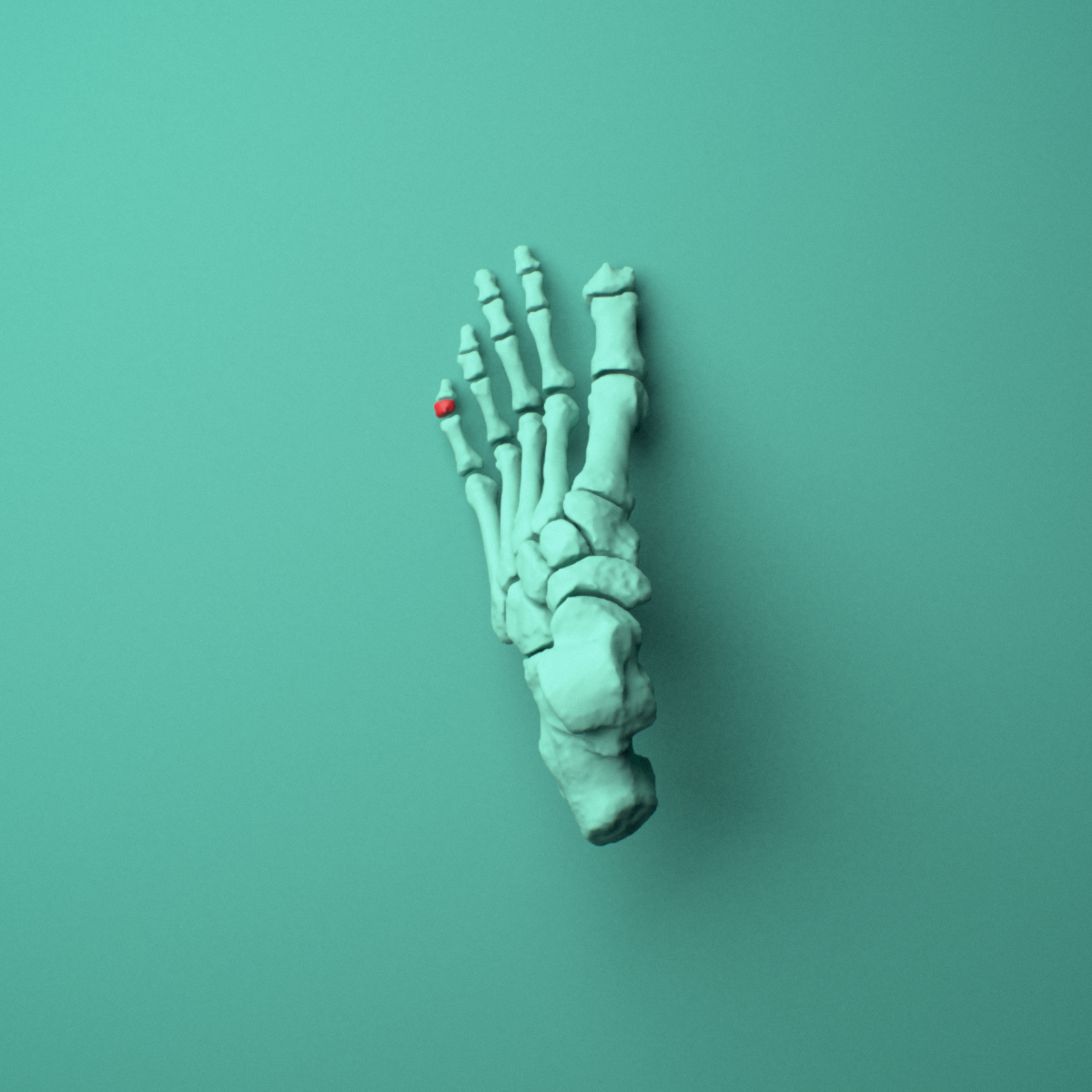 3D model of the Left little toe middle phalanx shown in position within a full foot and ankle model, superior view.