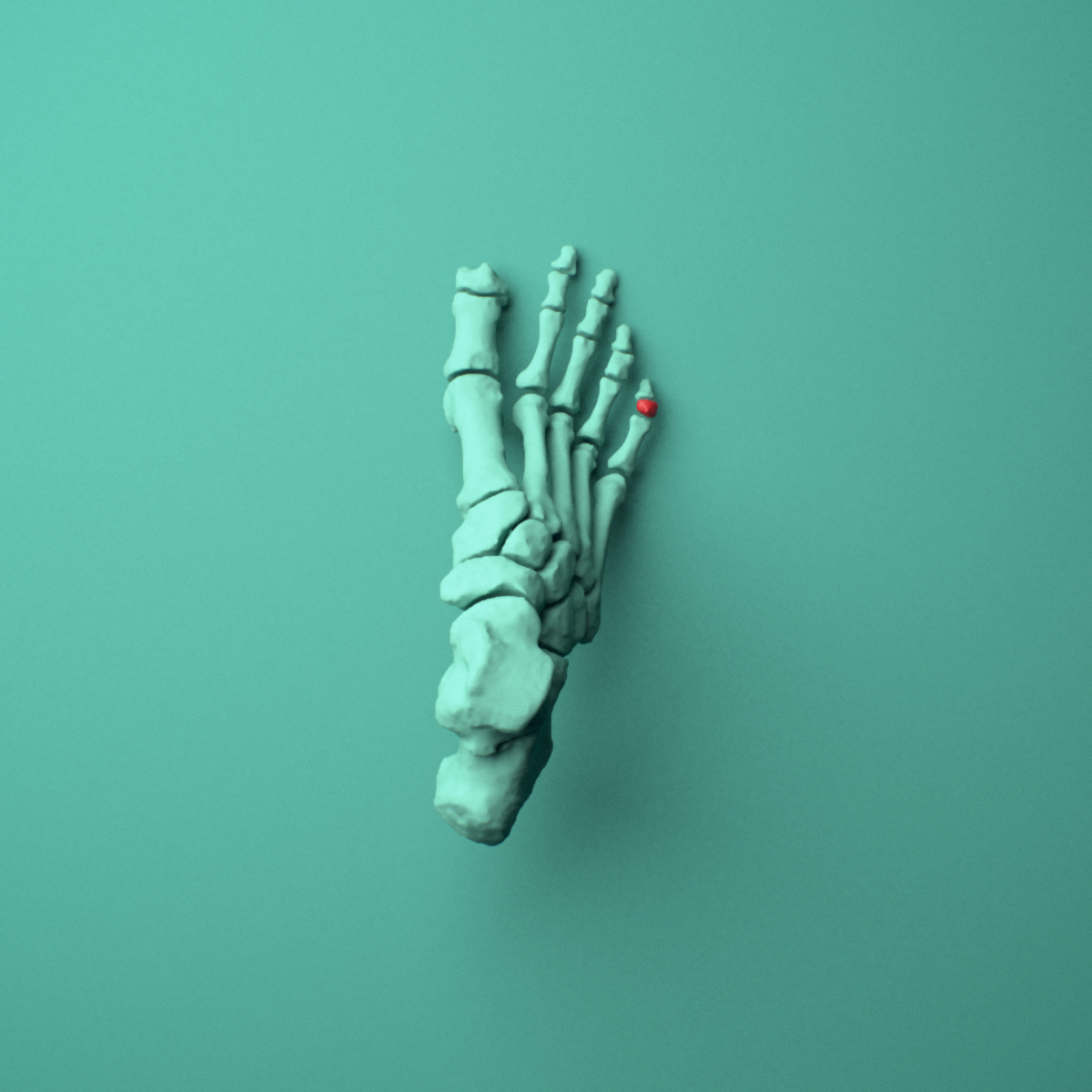 3D model of the Right little toe middle phalanx shown in position within a full foot and ankle model, superior view.