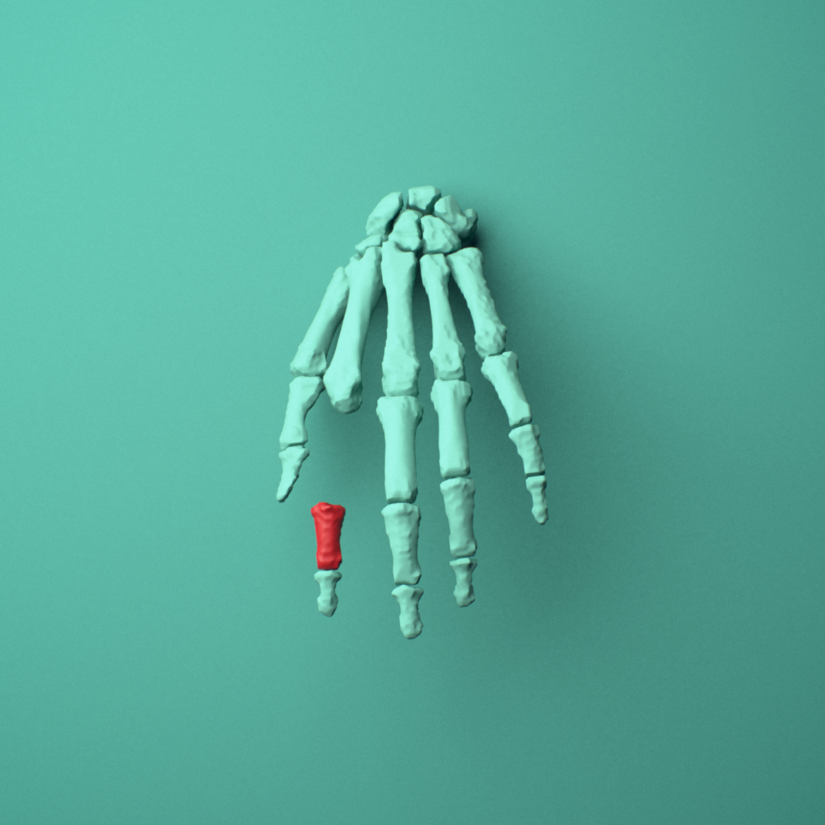 3D model of the Left index finger middle phalanx shown in position within a full hand and wrist model, anterior view.