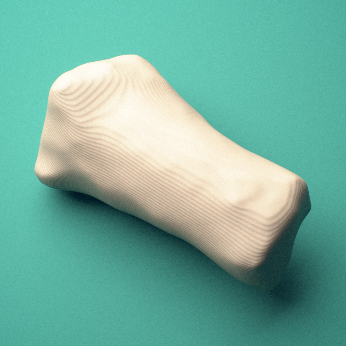 3D-printed Right little finger middle phalanx, close-up view showing the head (trochlea).