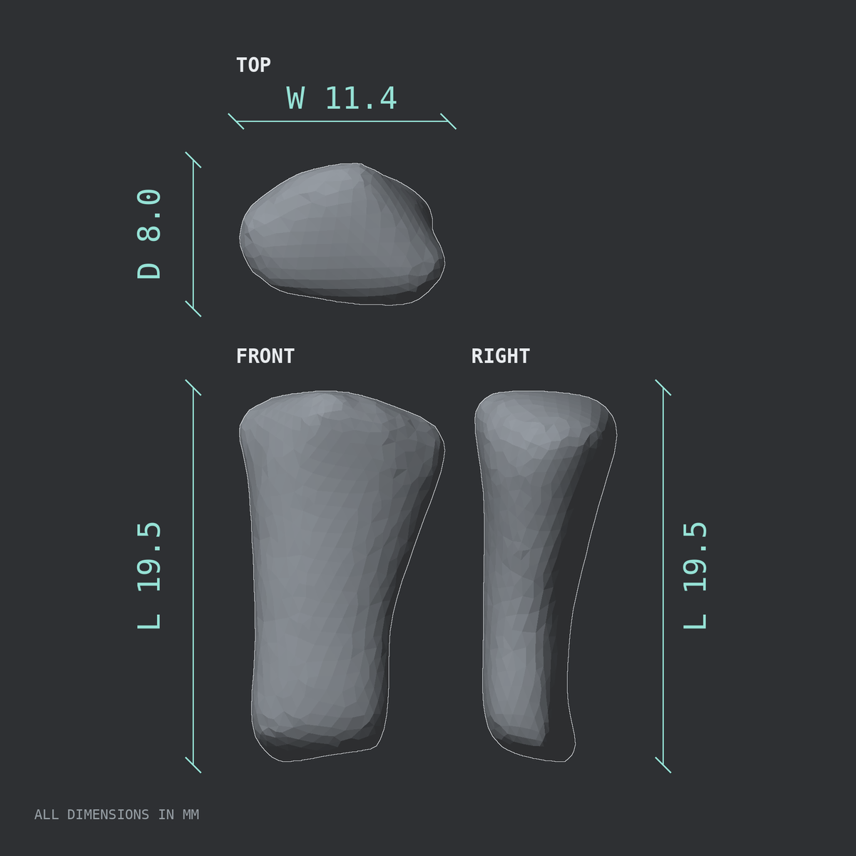 3D rendered dimensional drawing of the Right little finger middle phalanx, top, front, and side views.