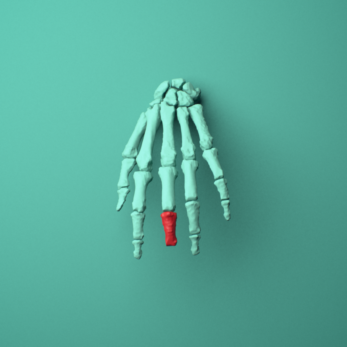 3D model of the Left middle finger middle phalanx shown in position within a full hand and wrist model, anterior view.