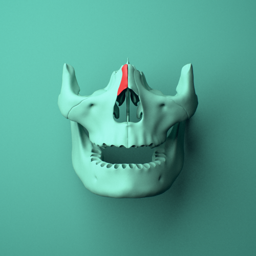 3D model of the Right nasal bone shown in position within a full skull model, anterior view.