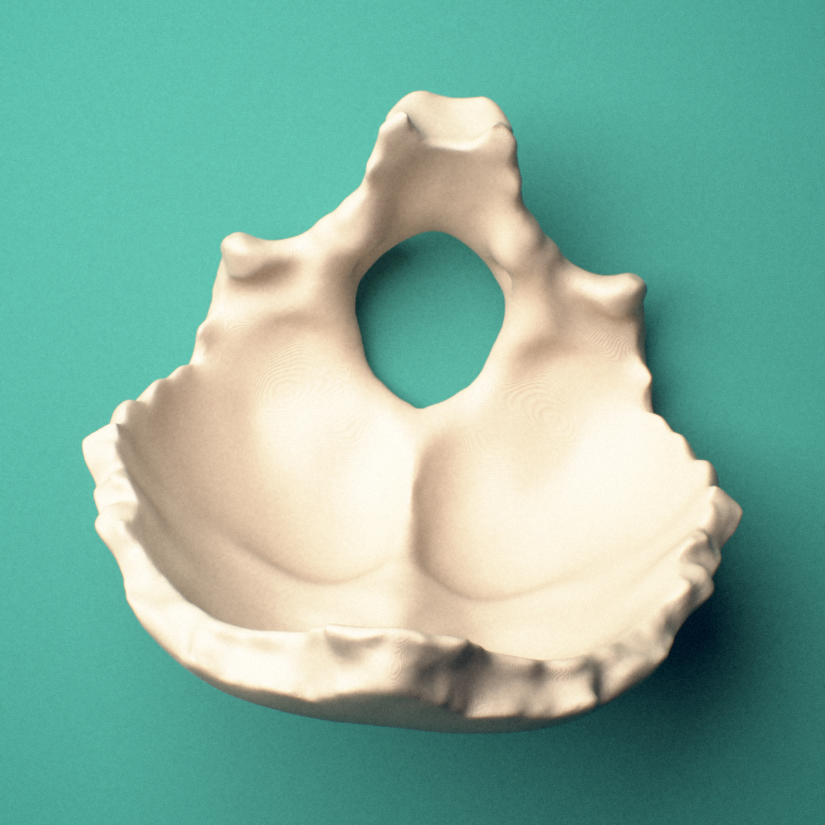 3D-printed Occipital bone, anterior view showing the foramen magnum.