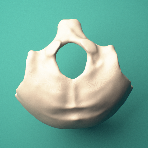 3D-printed Occipital bone, anterior oblique view showing the occipital condyles.
