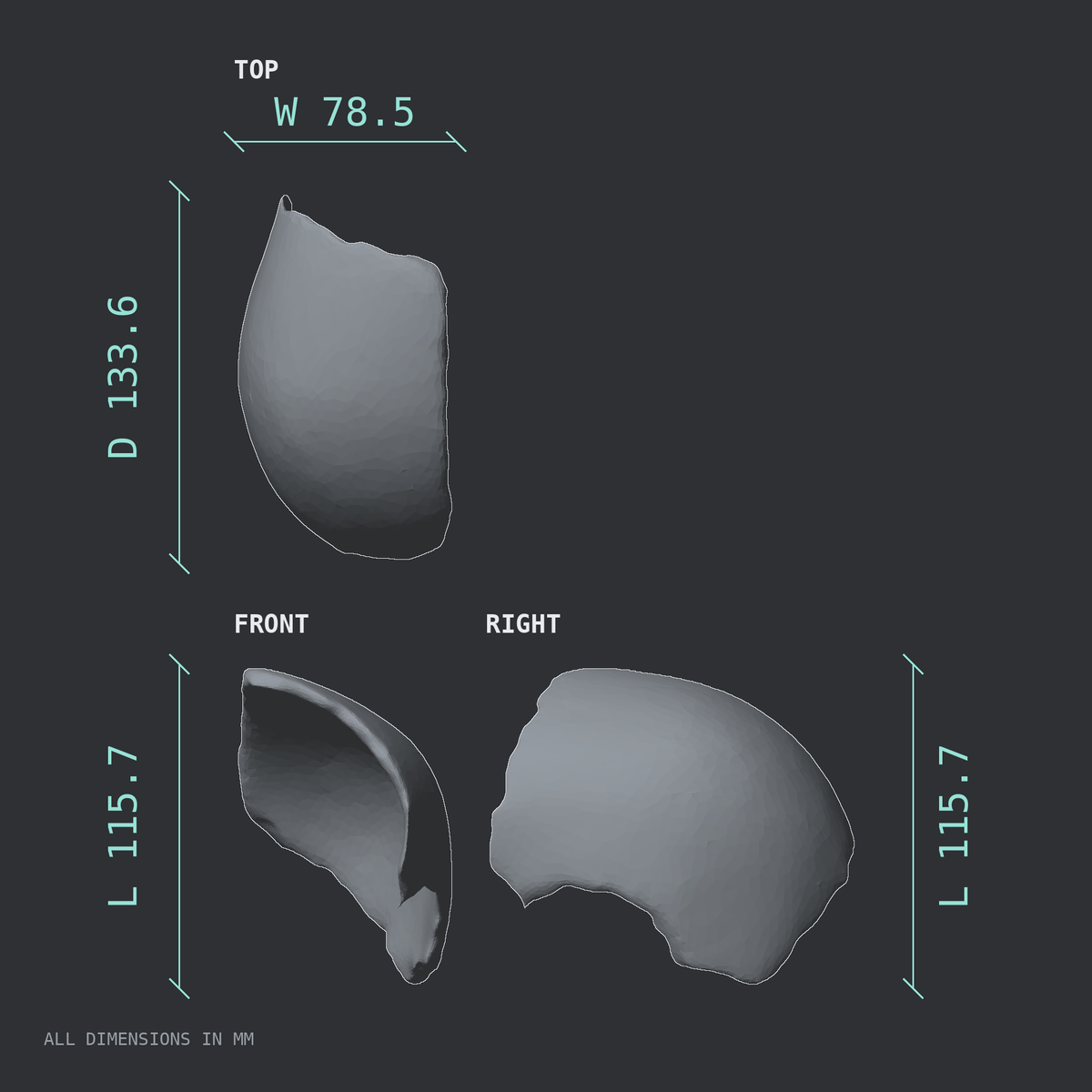 3D rendered dimensional drawing of the Left parietal bone, top, front, and side views.