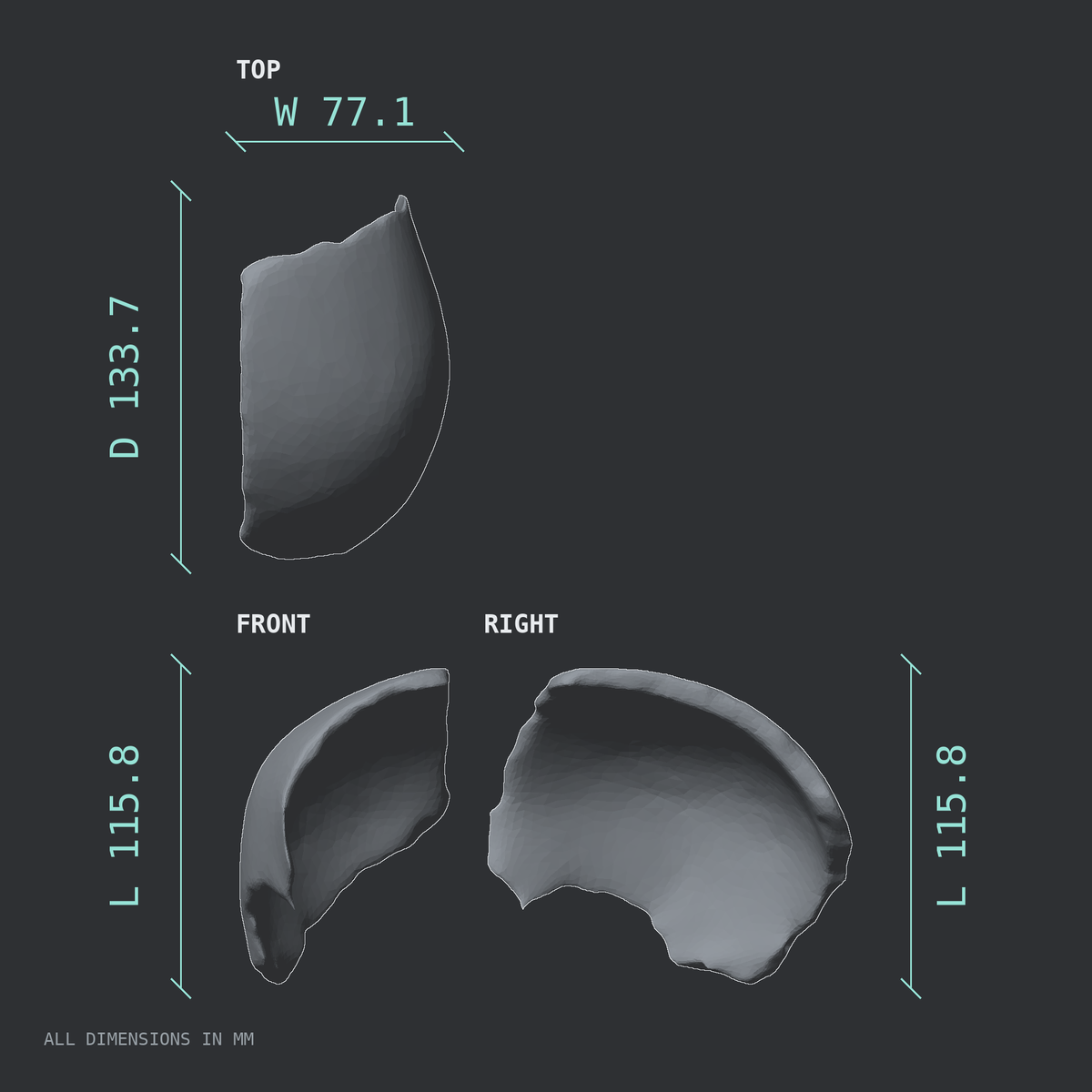 3D rendered dimensional drawing of the Right parietal bone, top, front, and side views.