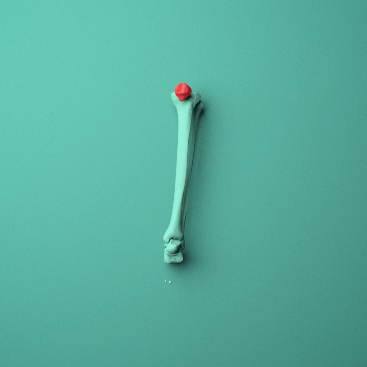 3D model of the Left patella (kneecap) shown in position within a full knee and lower leg model, anterior view.