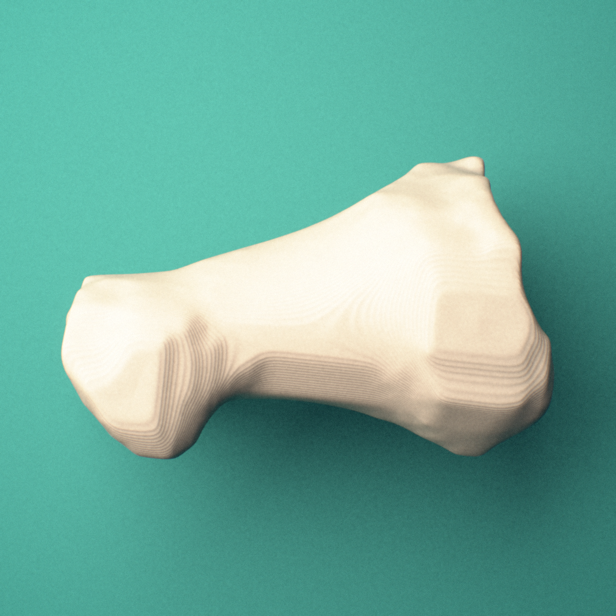 3D-printed Left big toe (hallux) proximal phalanx, oblique view showing the base and head (trochlea).