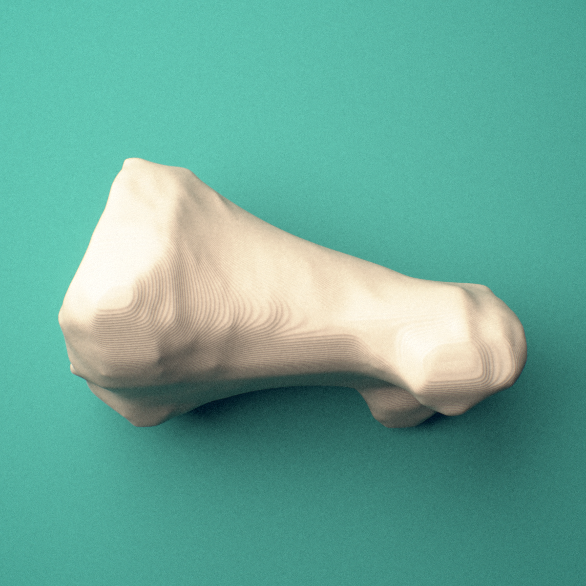 3D-printed Left big toe (hallux) proximal phalanx, close-up view showing the base.