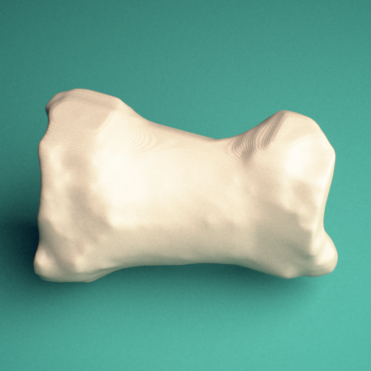 3D-printed Left big toe (hallux) proximal phalanx, lateral view showing the shaft.