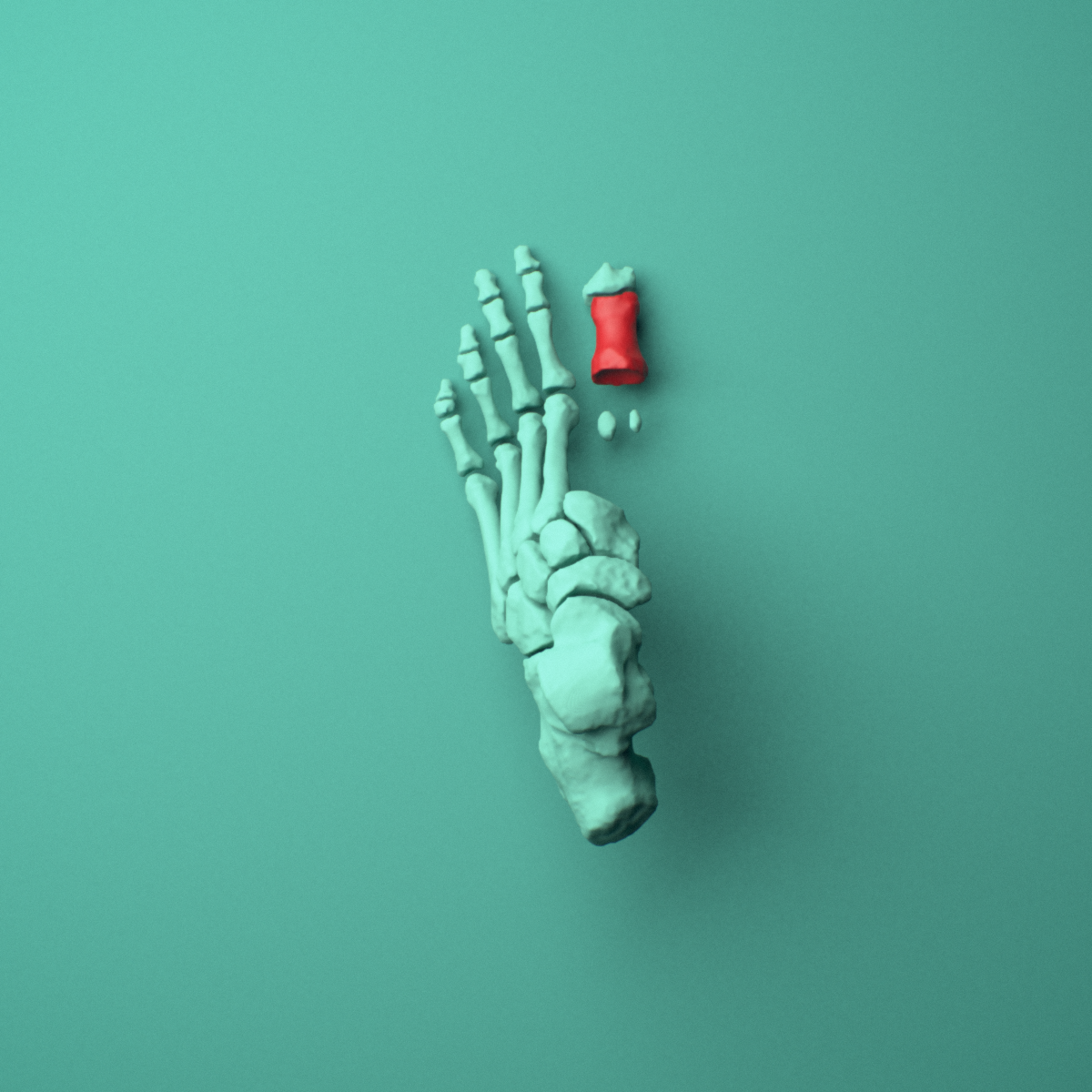3D model of the Left big toe (hallux) proximal phalanx shown in position within a full foot and ankle model, superior view.