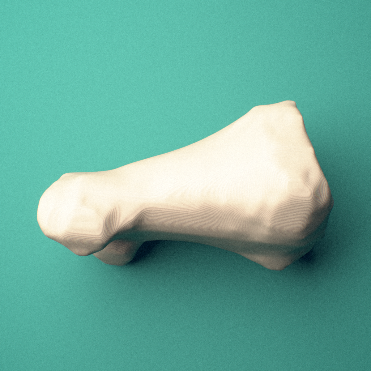 3D-printed Right big toe (hallux) proximal phalanx, oblique view showing the base and head (trochlea).