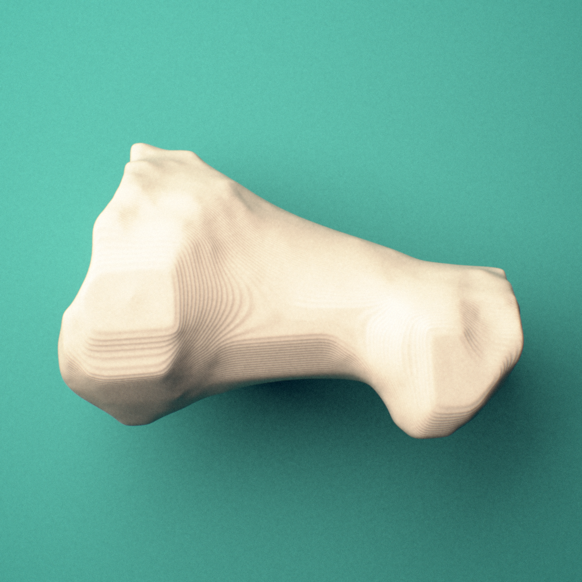 3D-printed Right big toe (hallux) proximal phalanx, close-up view showing the base.