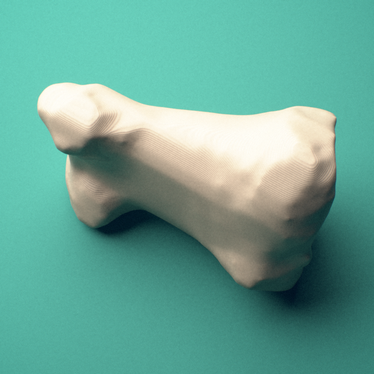 3D-printed Right big toe (hallux) proximal phalanx, close-up view showing the head (trochlea).