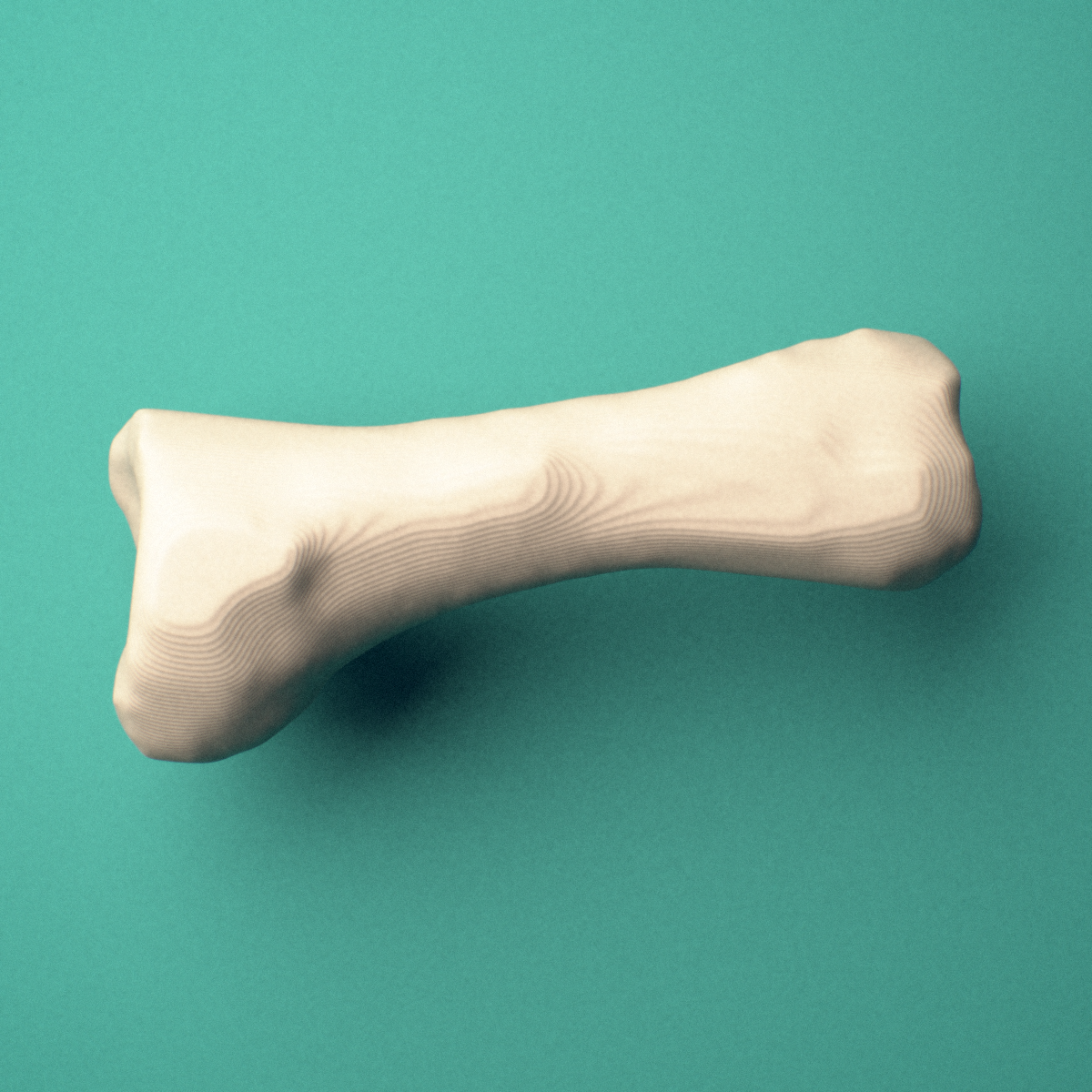 3D-printed Left second toe proximal phalanx, oblique view showing the base and head (trochlea).
