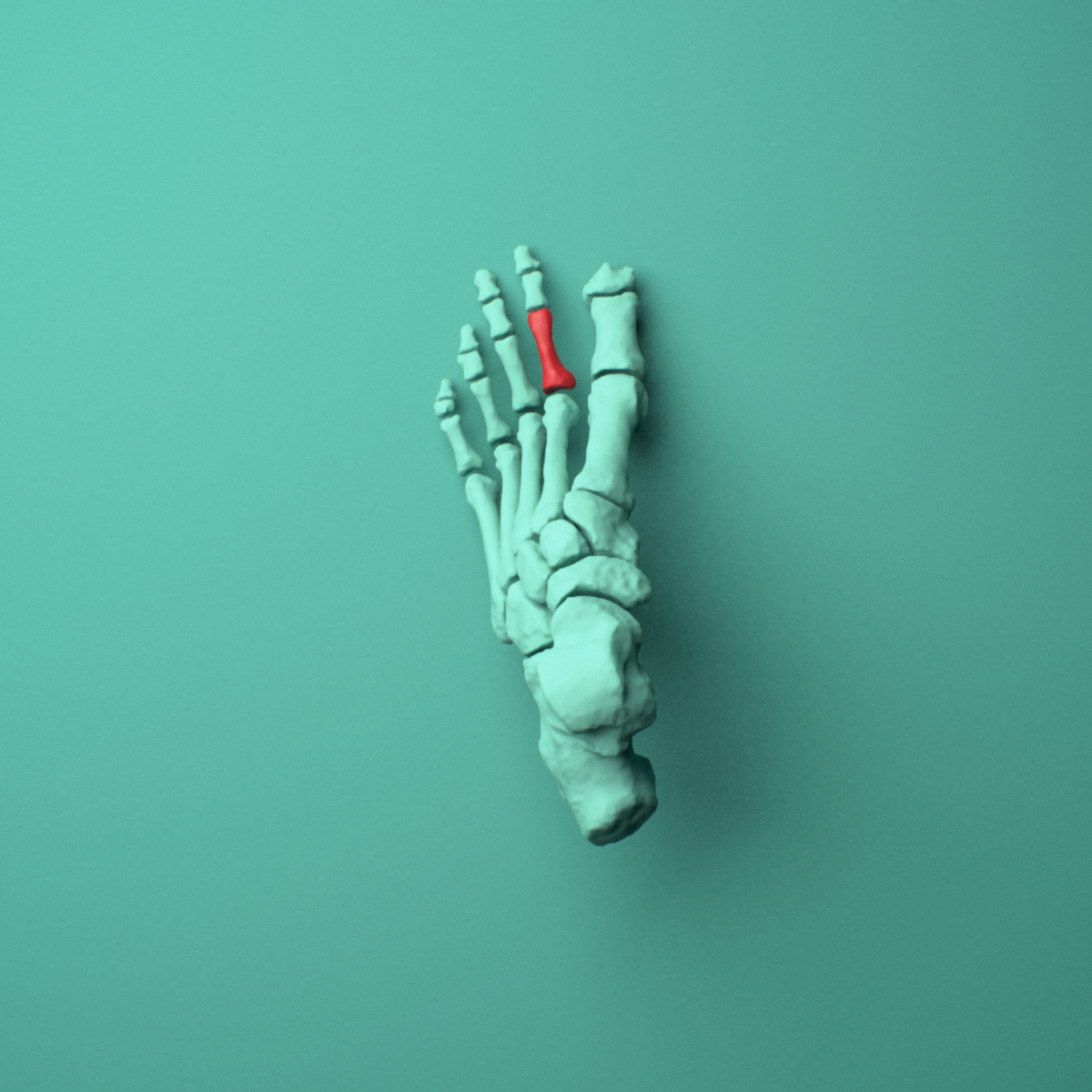 3D model of the Left second toe proximal phalanx shown in position within a full foot and ankle model, superior view.