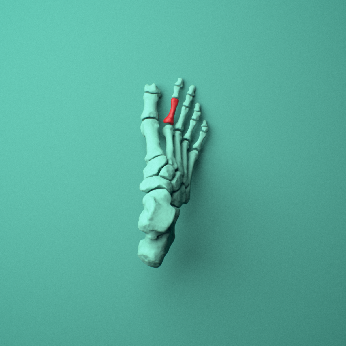 3D model of the Right second toe proximal phalanx shown in position within a full foot and ankle model, superior view.