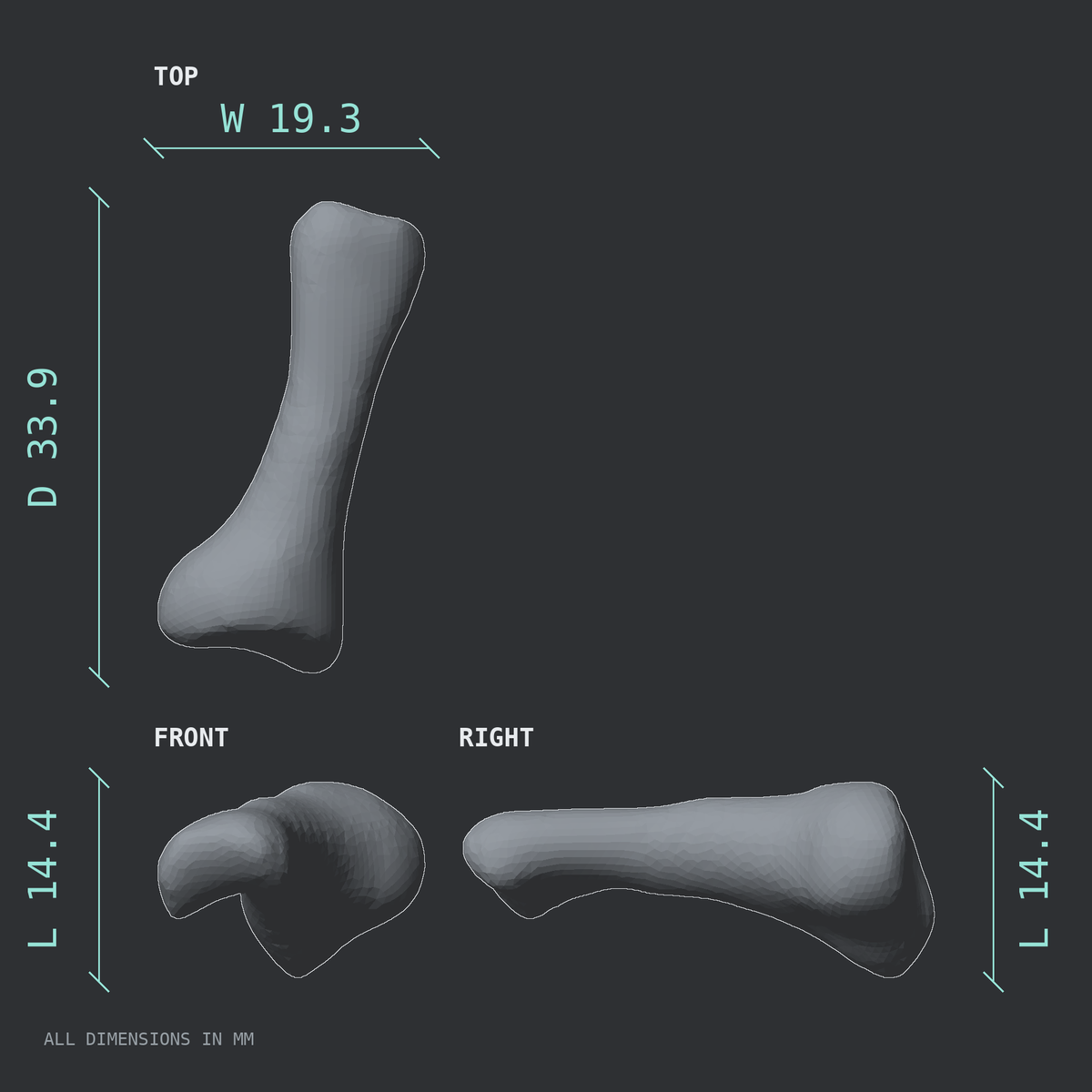 3D rendered dimensional drawing of the Right second toe proximal phalanx, top, front, and side views.