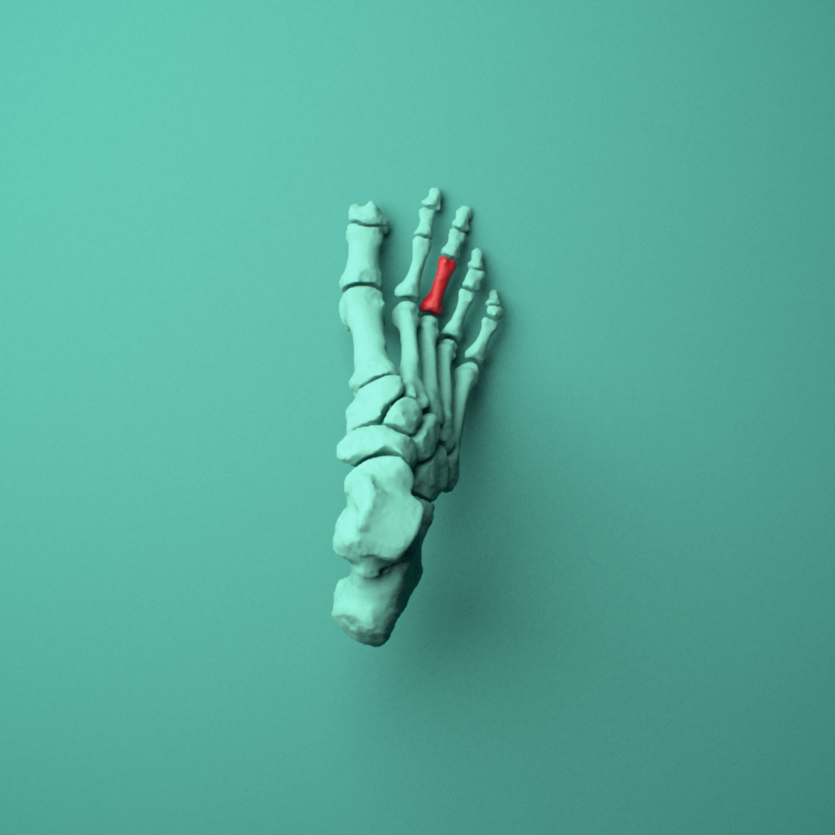 3D model of the Right third toe proximal phalanx shown in position within a full foot and ankle model, superior view.