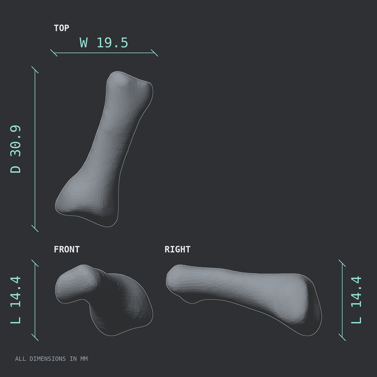 3D rendered dimensional drawing of the Right third toe proximal phalanx, top, front, and side views.