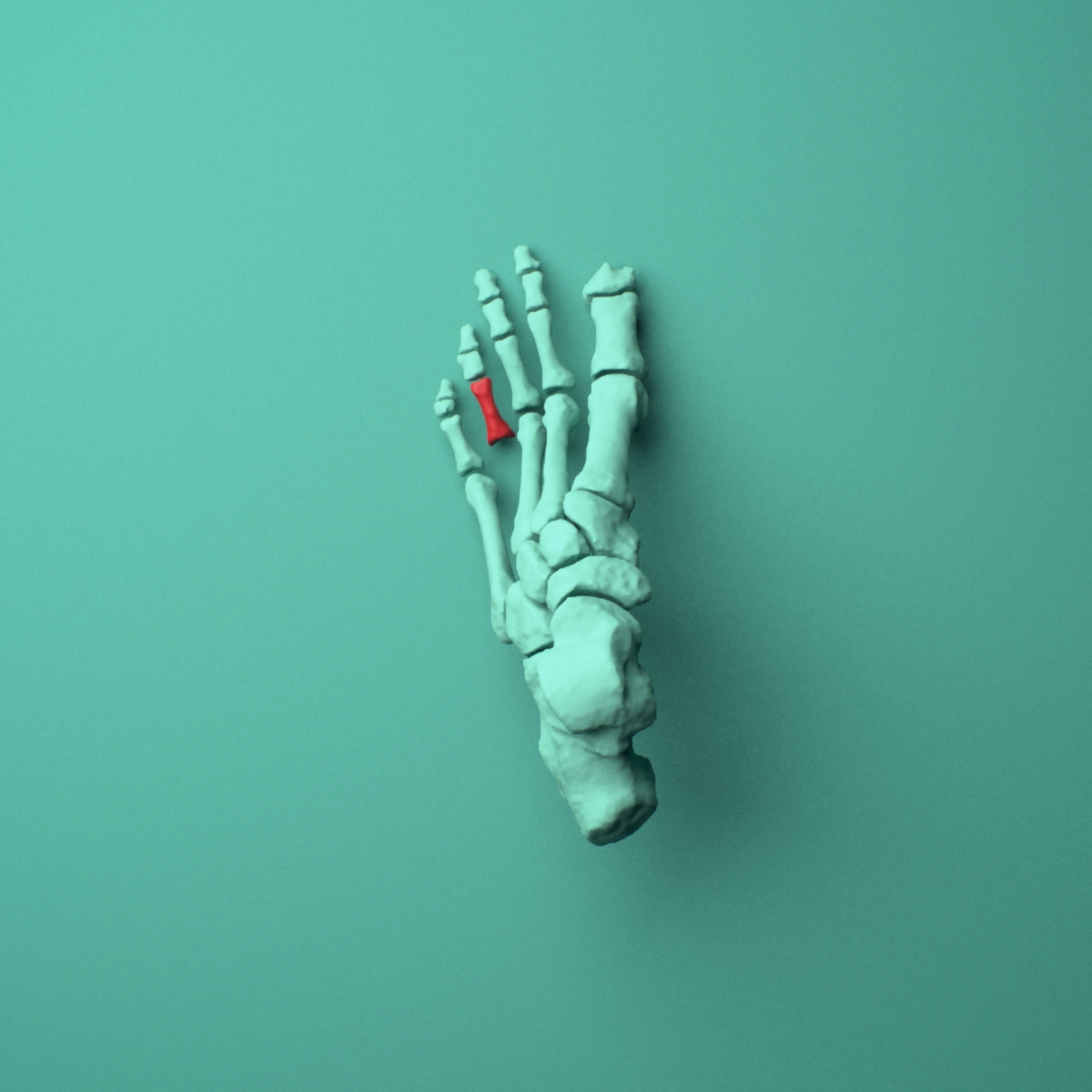 3D model of the Left fourth toe proximal phalanx shown in position within a full foot and ankle model, superior view.