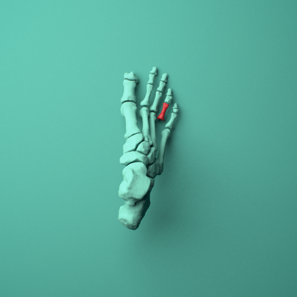 3D model of the Right fourth toe proximal phalanx shown in position within a full foot and ankle model, superior view.
