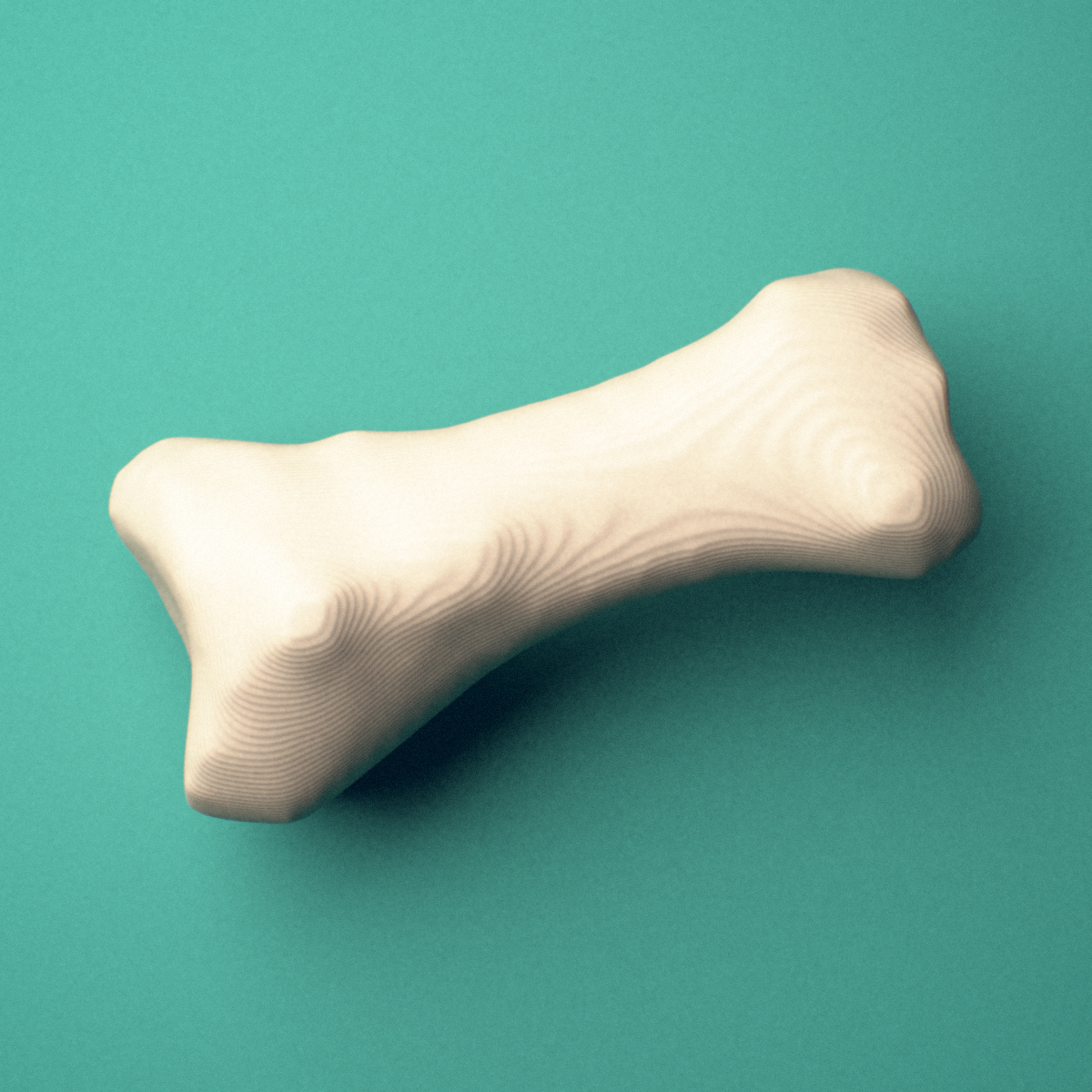 3D-printed Left little toe proximal phalanx, oblique view showing the base and head (trochlea).