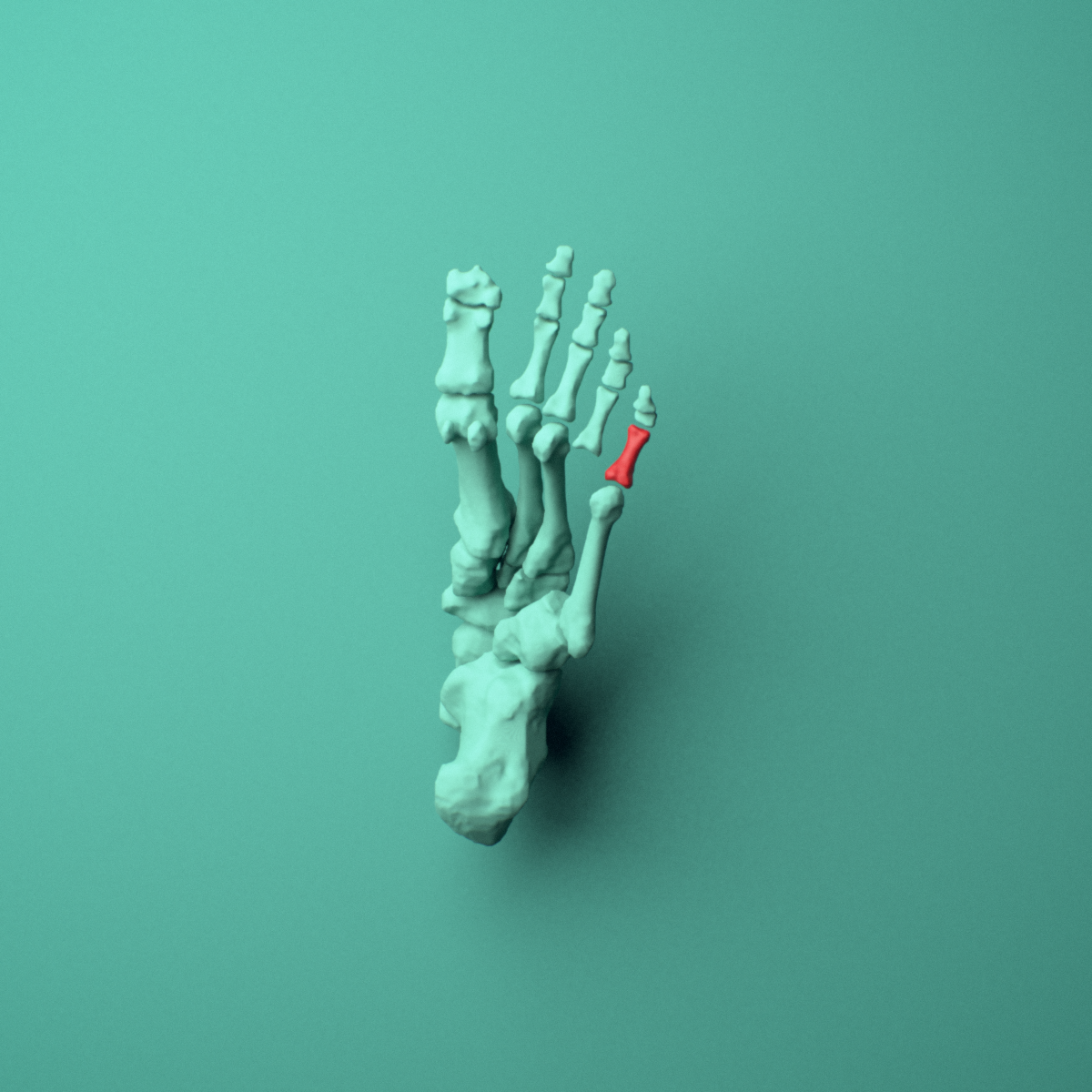 3D model of the Left little toe proximal phalanx shown in position within a full foot and ankle model, inferior view.
