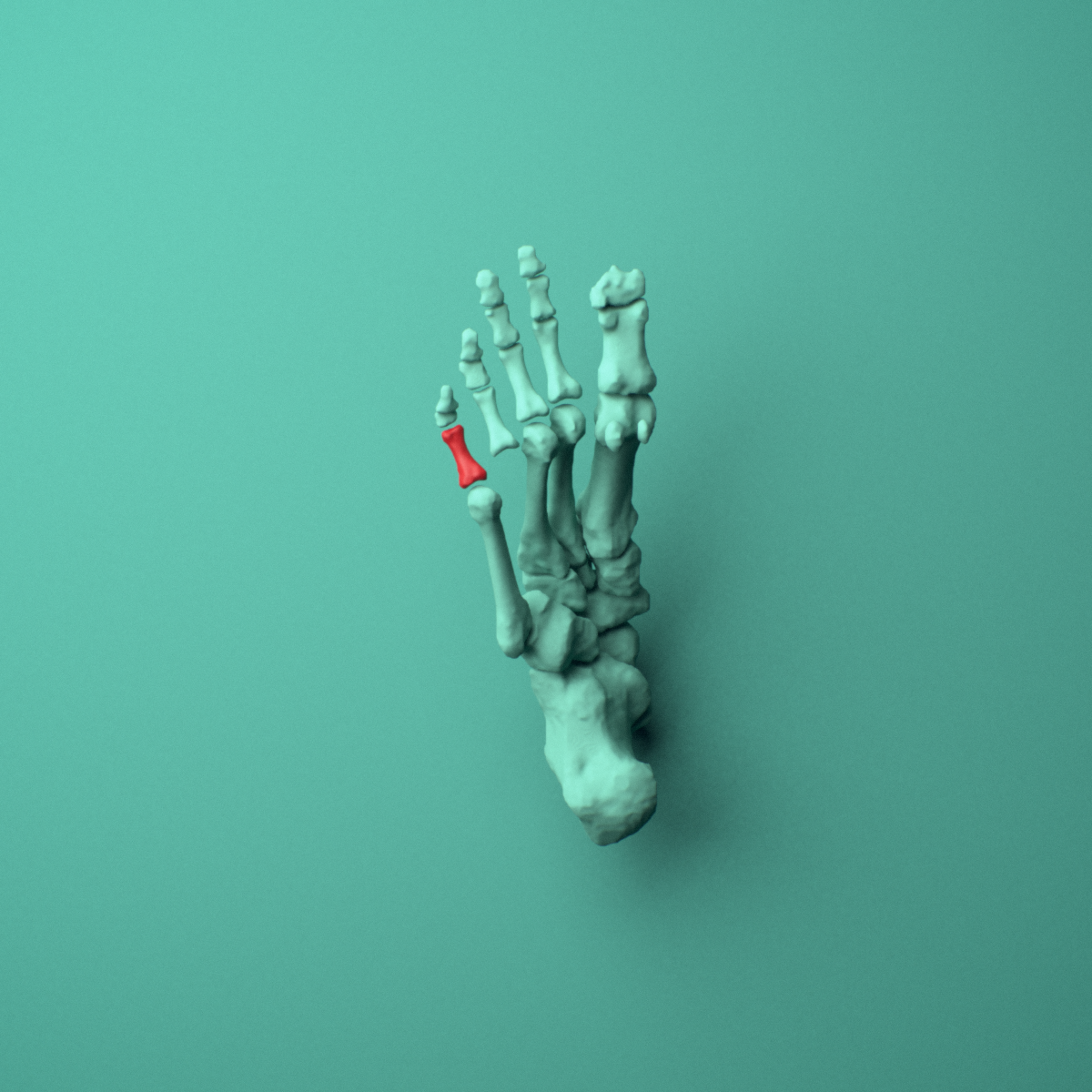 3D model of the Right little toe proximal phalanx shown in position within a full foot and ankle model, inferior view.