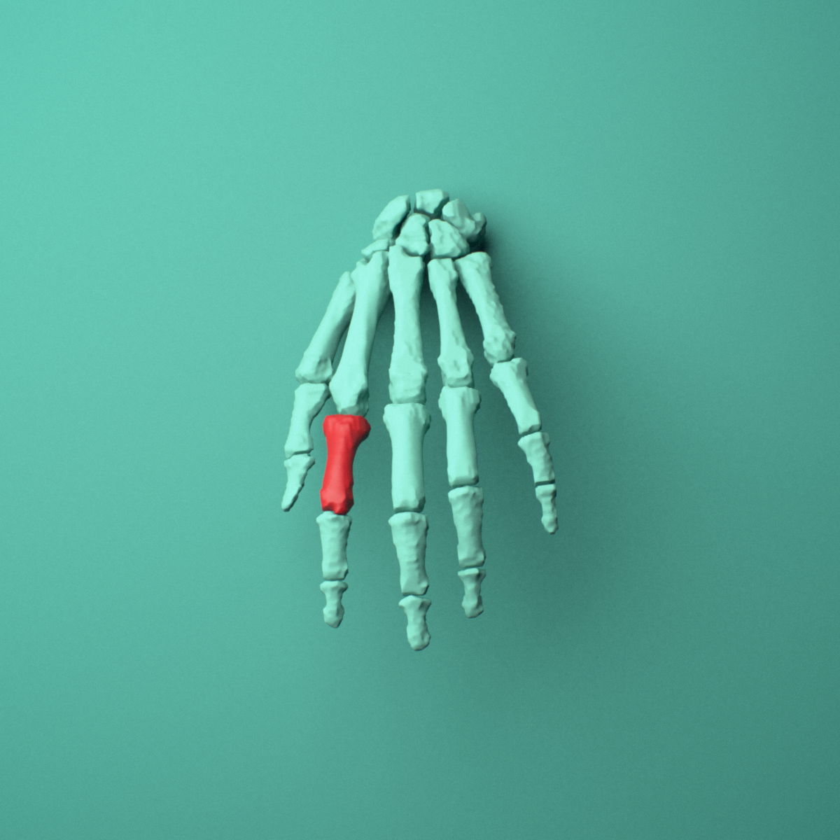 3D model of the Left index finger proximal phalanx shown in position within a full hand and wrist model, anterior view.